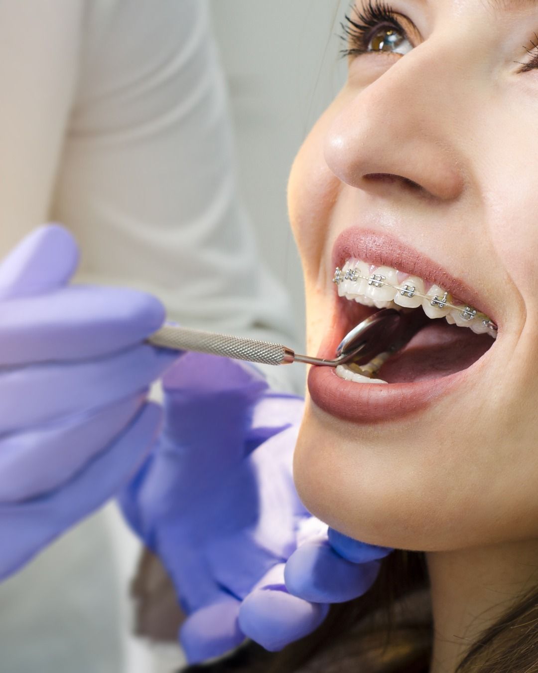 Orthodontist adjusting and maintaining patient braces